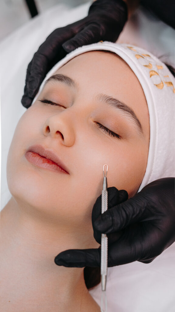 Чистка лица